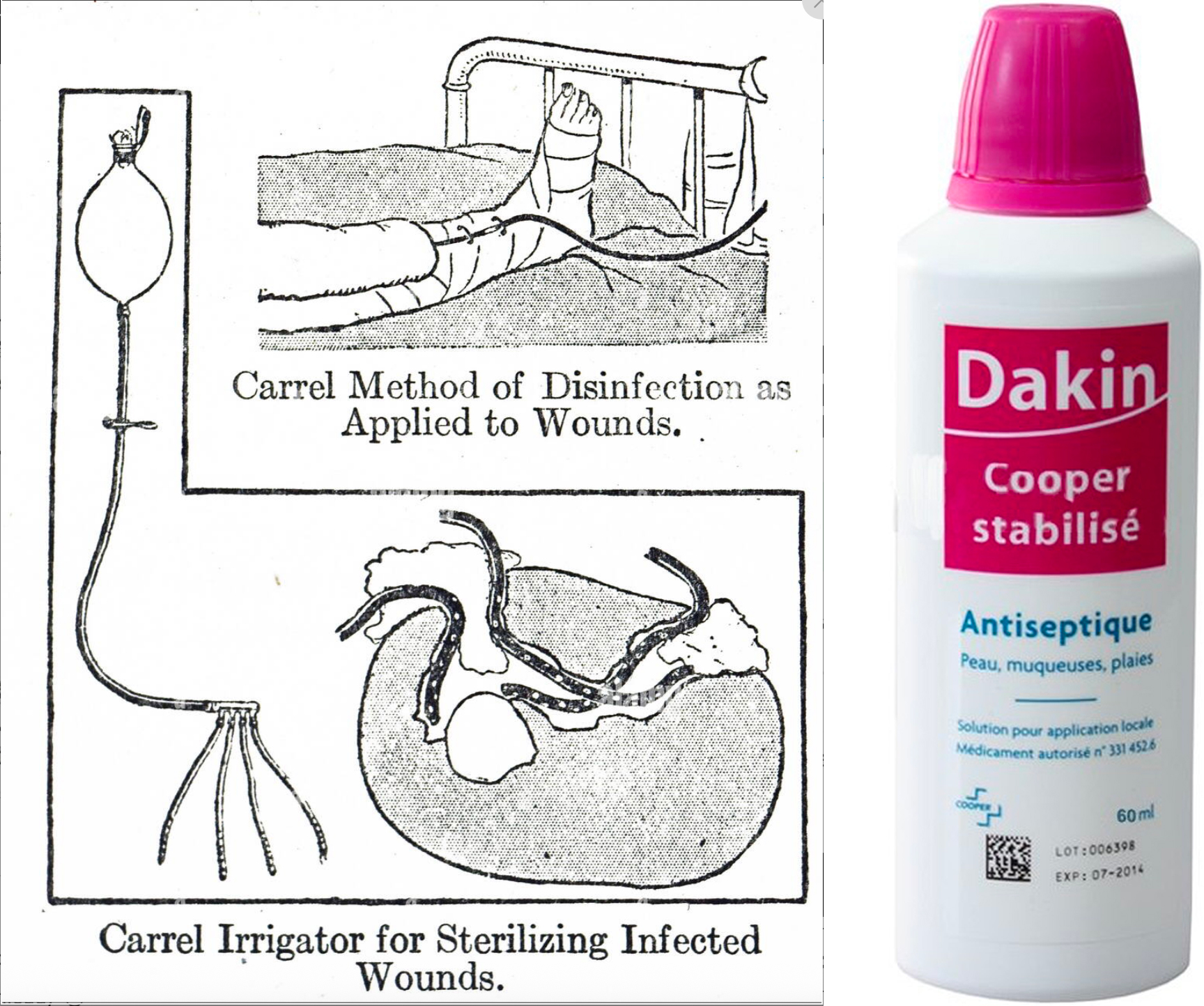 Dessin du procédé Carrel-Dakin et bouteille moderne de Solution Dakin